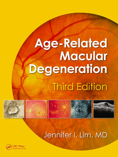 Book cover of Age-Related Macular Degeneration (3)