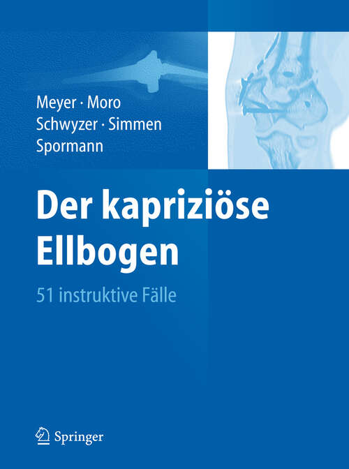 Book cover of Der kapriziöse Ellbogen: 51 instruktive Fälle (2012)