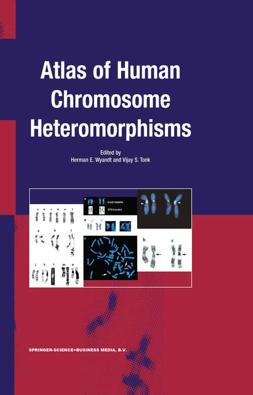 Book cover of Atlas of Human Chromosome Heteromorphisms (2004)
