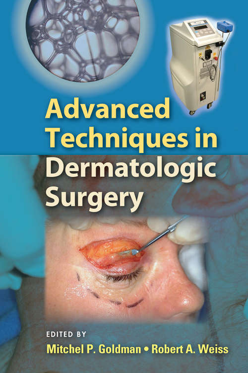 Book cover of Advanced Techniques in Dermatologic Surgery