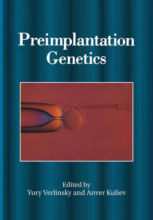 Book cover of Preimplantation Genetics (1991)