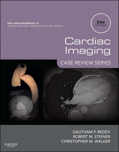 Book cover of Cardiac Imaging: Case Review Series E-Book (2) (Case Review)