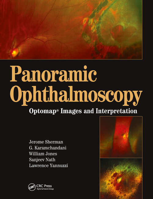 Book cover of Panoramic Ophthalmoscopy: Optomap Images and Interpretation