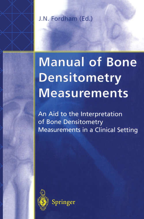 Book cover of Manual of Bone Densitometry Measurements: An Aid to the Interpretation of Bone Densitometry Measurements in a Clinical Setting (2000)
