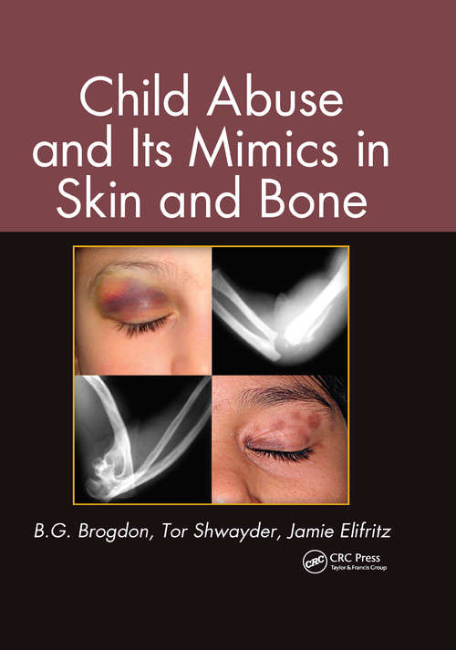 Book cover of Child Abuse and its Mimics in Skin and Bone