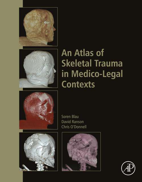 Book cover of An Atlas of Skeletal Trauma in Medico-Legal Contexts