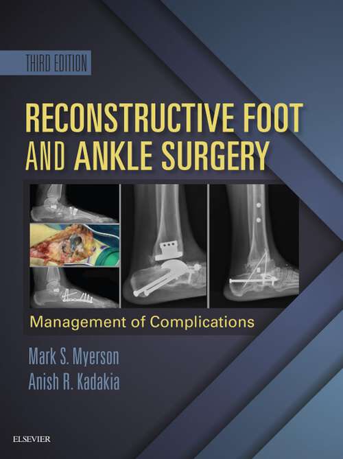 Book cover of Reconstructive Foot and Ankle Surgery: Management Of Complications (3)