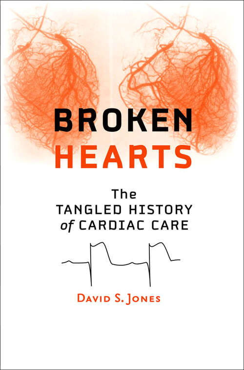 Book cover of Broken Hearts: The Tangled History of Cardiac Care