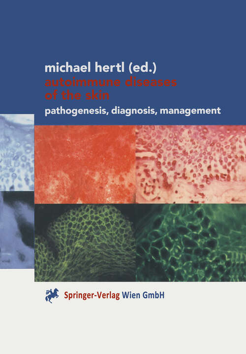 Book cover of Autoimmune Diseases of the Skin: Pathogenesis, Diagnosis, Management (2001)