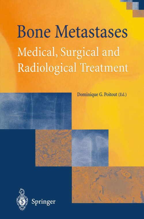 Book cover of Bone Metastases: Medical, Surgical and Radiological Treatment (2002)