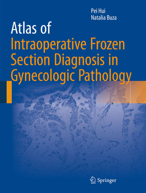 Book cover of Atlas of Intraoperative Frozen Section Diagnosis in Gynecologic Pathology (1st ed. 2015)