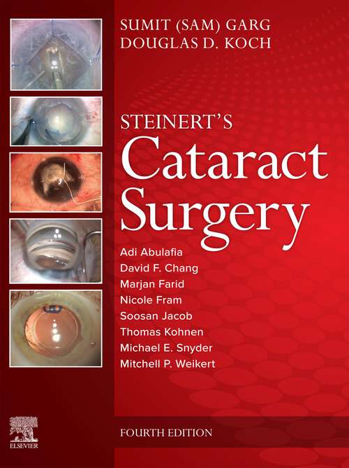 Book cover of Cataract Surgery