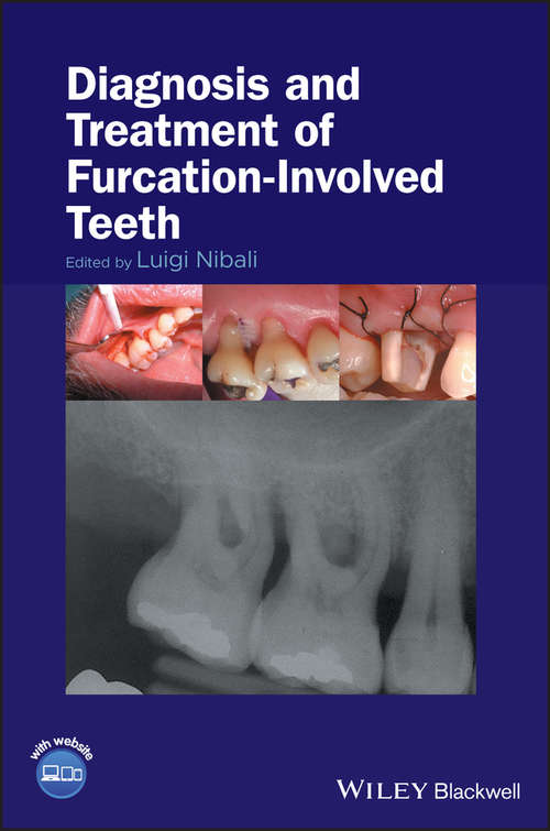 Book cover of Diagnosis and Treatment of Furcation-Involved Teeth