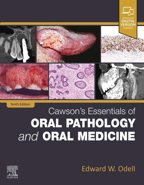 Book cover of Cawson's Essentials of Oral Pathology and Oral Medicine - E-Book: Cawson's Essentials of Oral Pathology and Oral Medicine - E-Book