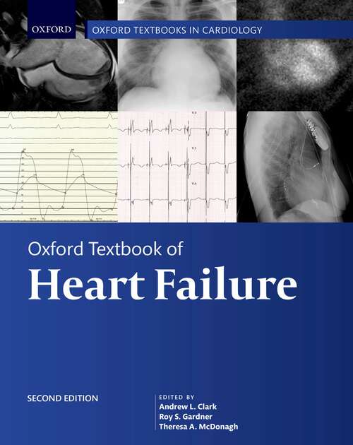 Book cover of Oxford Textbook of Heart Failure (Oxford Textbooks in Cardiology)