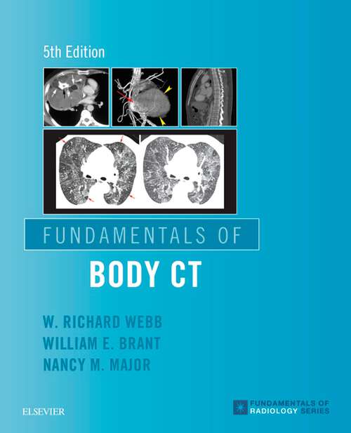 Book cover of Fundamentals of Body CT E-Book: Expert Consult - Online And Print (5) (Fundamentals of Radiology)