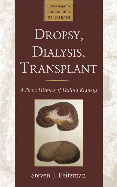 Book cover of Dropsy, Dialysis, Transplant: A Short History of Failing Kidneys (Johns Hopkins Biographies of Disease)