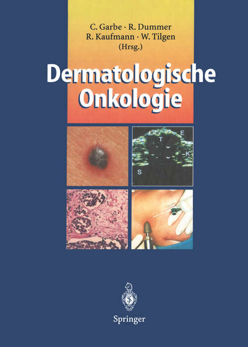 Book cover of Dermatologische Onkologie (1997)