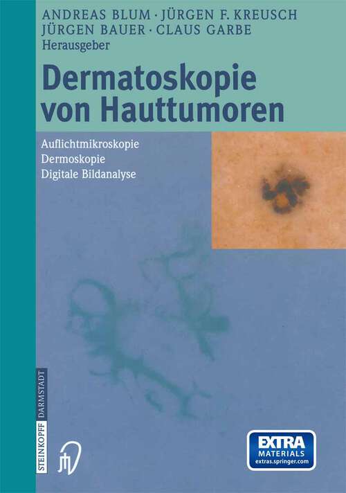 Book cover of Dermatoskopie von Hauttumoren: Auflichtmikroskopie — Dermoskopie — Digitale Bildanalyse (2003)