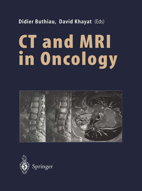 Book cover of CT and MRI in Oncology (1998)