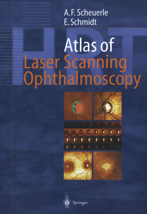 Book cover of Atlas of Laser Scanning Ophthalmoscopy (2004)