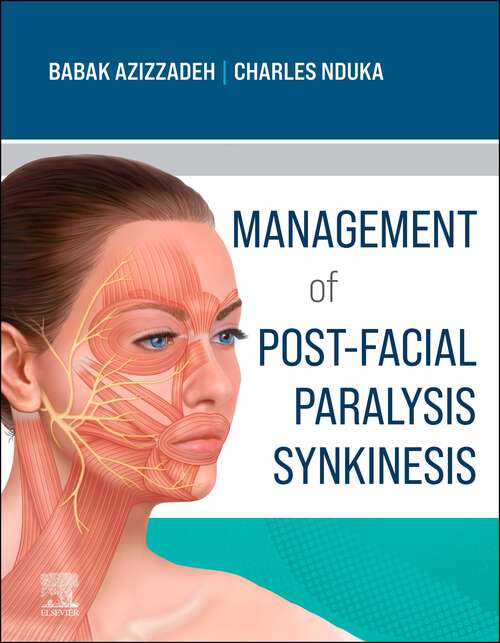 Book cover of Management of Post-Facial Paralysis Synkinesis