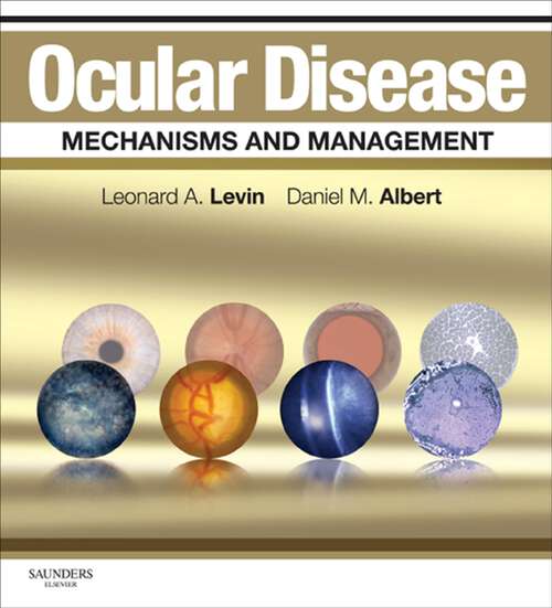 Book cover of Ocular Disease: Expert Consult - Online and Print