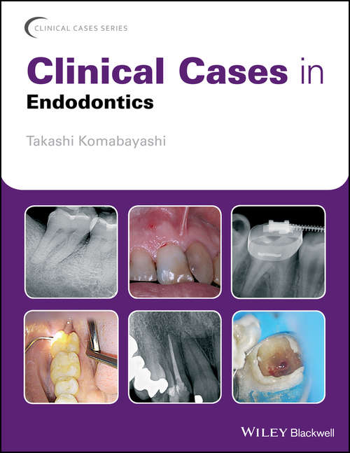 Book cover of Clinical Cases in Endodontics (Clinical Cases (Dentistry))