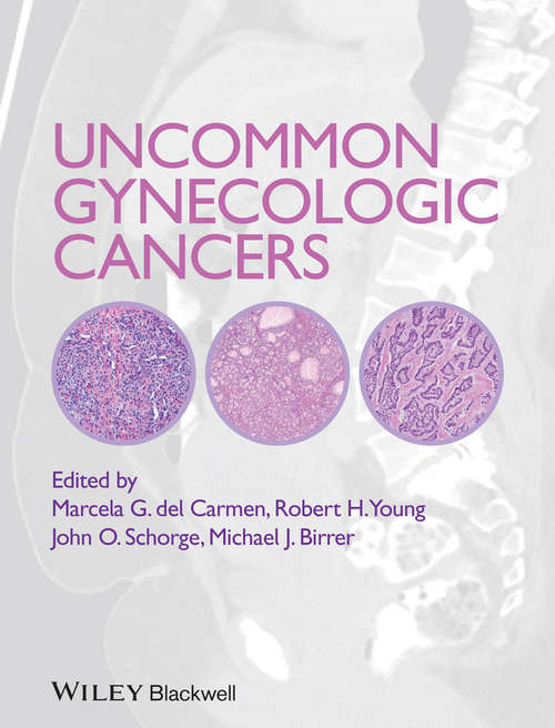 Book cover of Uncommon Gynecologic Cancers