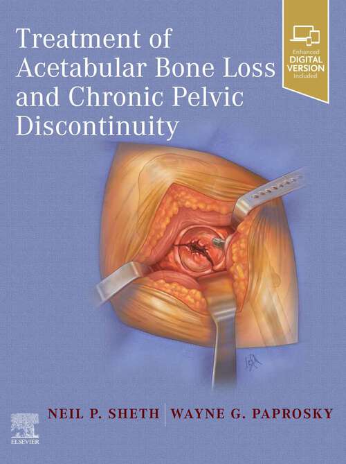 Book cover of Treatment of Acetabular Bone Loss and Chronic Pelvic Discontinuity - E-Book: Treatment of Acetabular Bone Loss and Chronic Pelvic Discontinuity - E-Book
