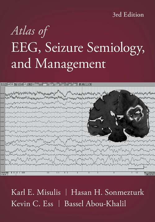 Book cover of Atlas of EEG, Seizure Semiology, and Management