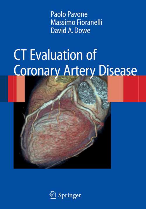 Book cover of CT Evaluation of Coronary Artery Disease (2009)