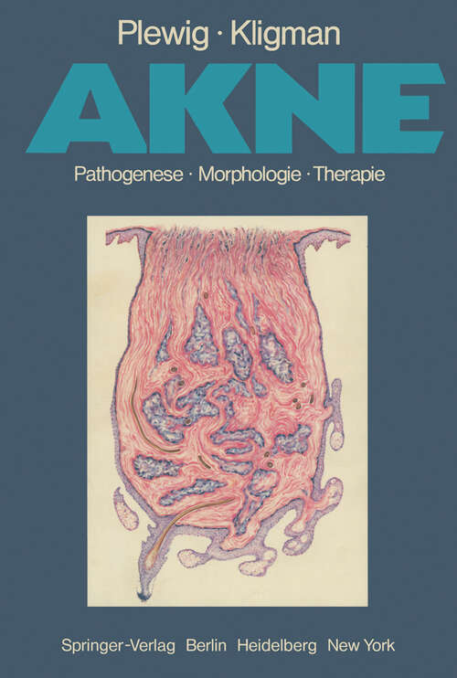 Book cover of Akne: Pathogenese Morphologie Therapie (1978)