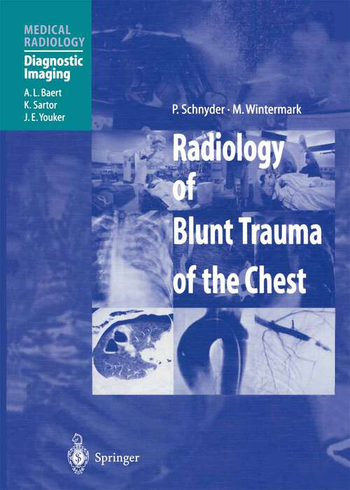 Book cover of Radiology of Blunt Trauma of the Chest (2000) (Medical Radiology)