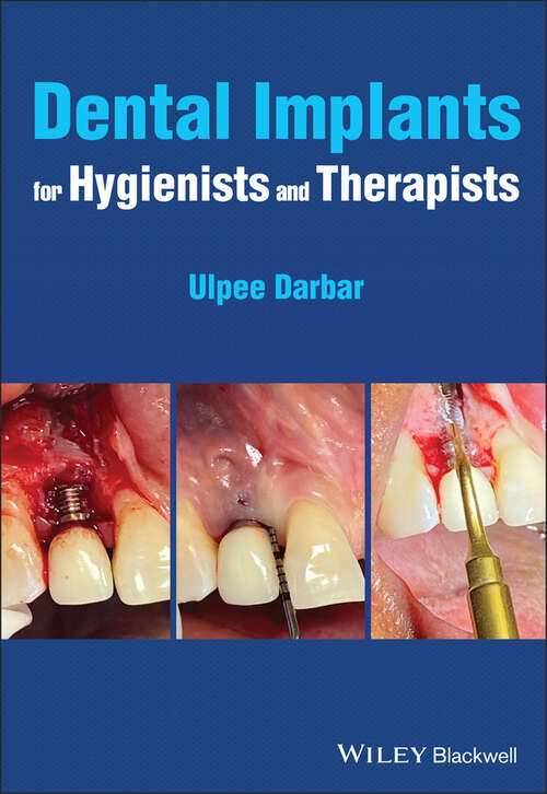 Book cover of Dental Implants for Hygienists and Therapists