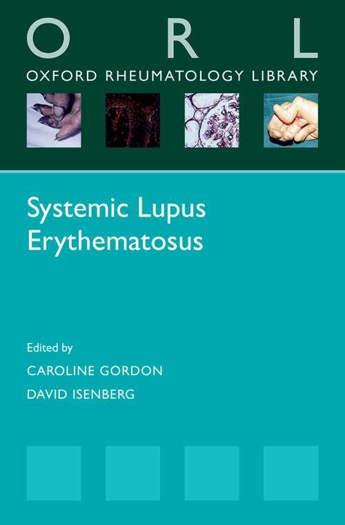 Book cover of Systemic Lupus Erythematosus (Oxford Rheumatology Library)
