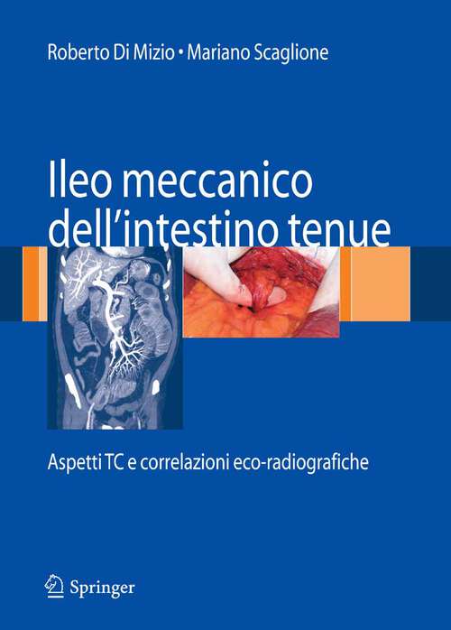 Book cover of Ileo meccanico dell'intestino tenue: Aspetti TC e correlazioni eco-radiografiche (2007)