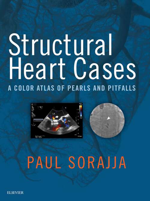 Book cover of Structural Heart Cases E-Book: A Color Atlas of Pearls and Pitfalls