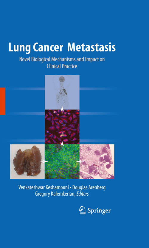 Book cover of Lung Cancer Metastasis: Novel Biological Mechanisms and Impact on Clinical Practice (2010)