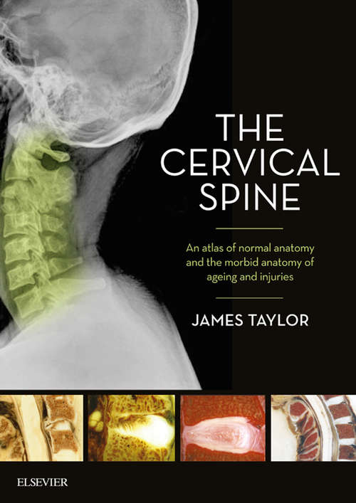 Book cover of The Cervical Spine: An atlas of normal anatomy and the morbid anatomy of ageing and injuries