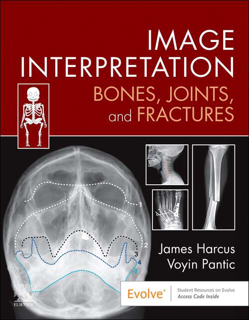 Book cover of Image Interpretation: Image Interpretation: Bones, Joints, and Fractures - E-Book