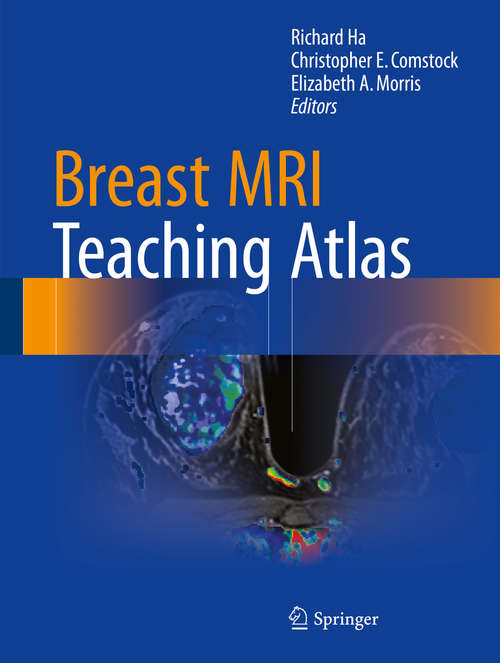 Book cover of Breast MRI Teaching Atlas