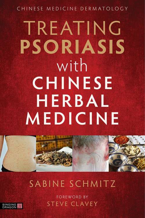 Book cover of Treating Psoriasis with Chinese Herbal Medicine (Revised Edition): A Practical Handbook