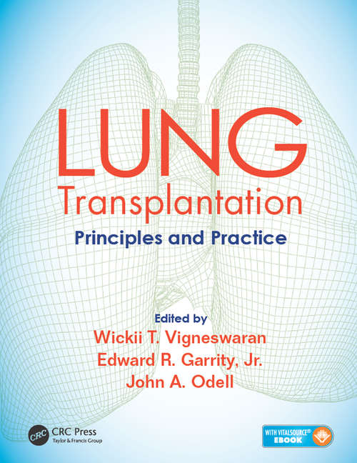 Book cover of Lung Transplantation: Principles and Practice