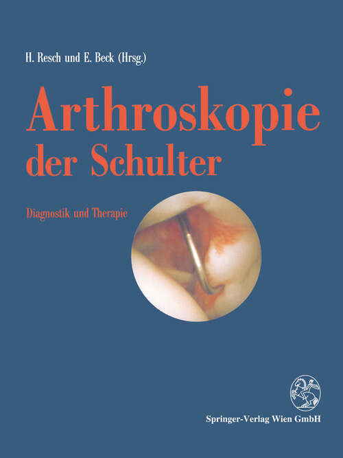 Book cover of Arthroskopie der Schulter: Diagnostik und Therapie (1991)