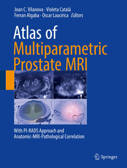 Book cover of Atlas of Multiparametric Prostate MRI: With PI-RADS Approach and Anatomic-MRI-Pathological Correlation